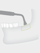 W&H B1 — Пилка для кости