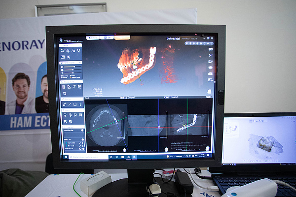 Тотальная реабилитация окклюзии7.jpg