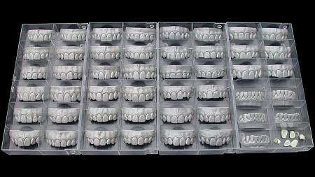 Exocad Tooth Library - дополнительная библиотека естественных зубов