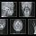GENORAY Papaya 3D 23x14 - компьютерный томограф с цефалостатом 