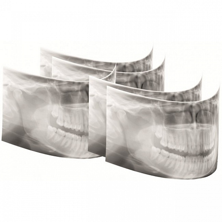 KaVo Pan eXam Plus 3D - цифровая панорамная рентгенодиагностическая система с функцией 3D-томографии 6x8 см и возможностью дооснащения модулем цефалостата