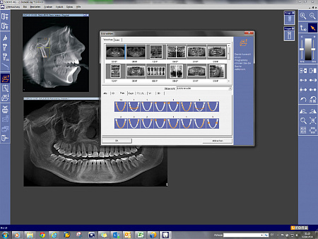 Sirona Orthophos XG 3 DS – Ортопантомограф